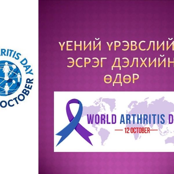 ҮЕНИЙ ҮРЭВСЛИЙН ЭСРЭГ ӨДРИЙГ ТЭМДЭГЛЭН ӨНГӨРҮҮЛЛЭЭ